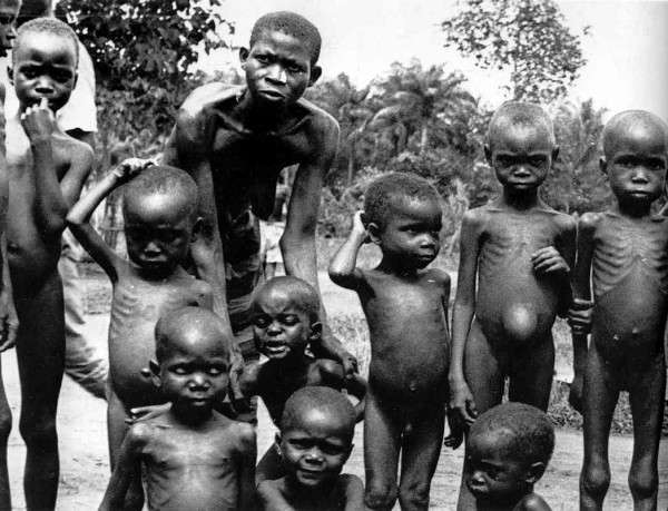 Image credit: Starving Ibos in Biafra (Nigeria) — 1967/8, via http://www.kingsacademy.com/mhodges/03_The-World-since-1900/11_The-Bewildering-60s/11i_The-Emergence-of-a-'Third-World'.htm.