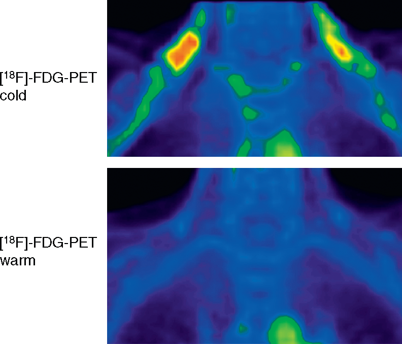 Experimental Biology 2011- Comparative Physiology of Brown Adipose Tissue - Vimarsana News