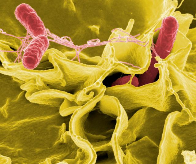 Bidding Antibiotics Adieu | ScienceBlogs - Vimarsana News