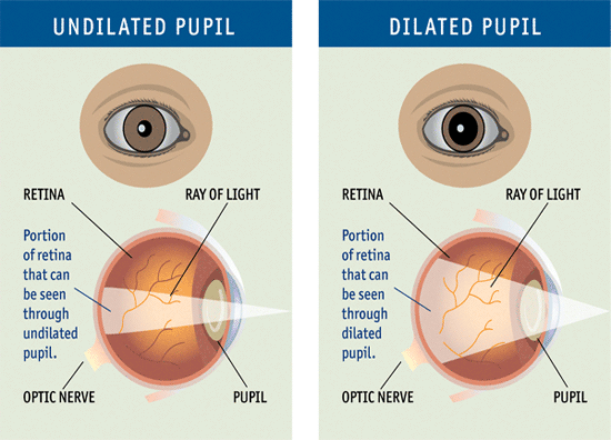 Dilated Eyes